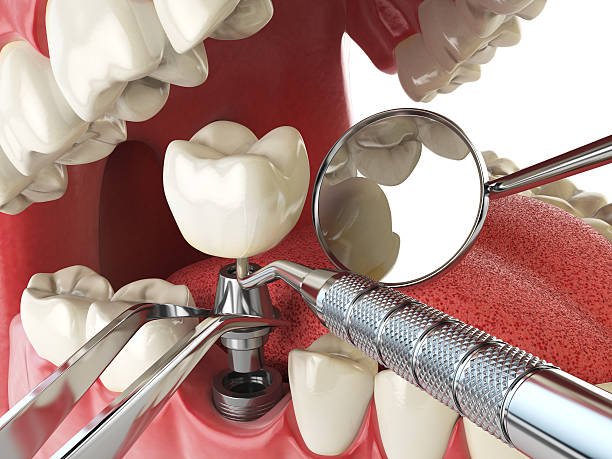 Best Emergency Root Canal Treatment in Mayville, WI
