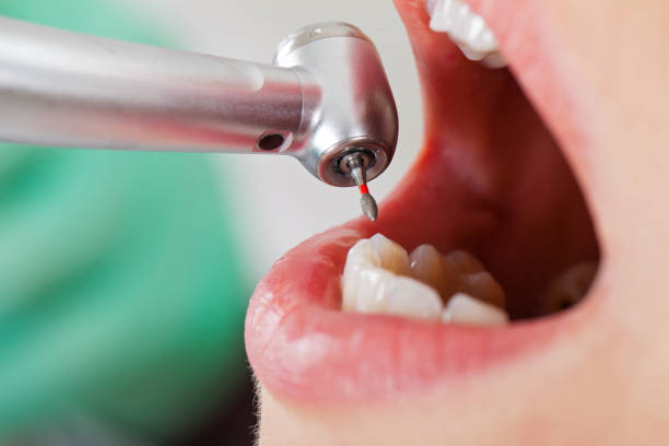 Best Emergency Treatment for Dental Infections or Abscesses in Mayville, WI